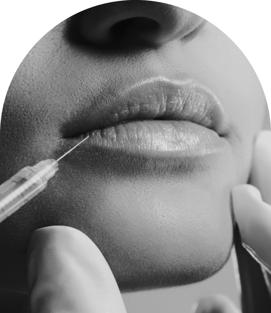  Botox - Réduction des Rides d'Expression