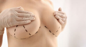 Quand des  Seins Volumineux Deviennent un Fardeau