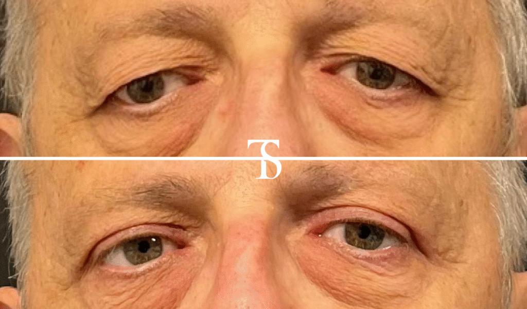 avant après theo sedbon