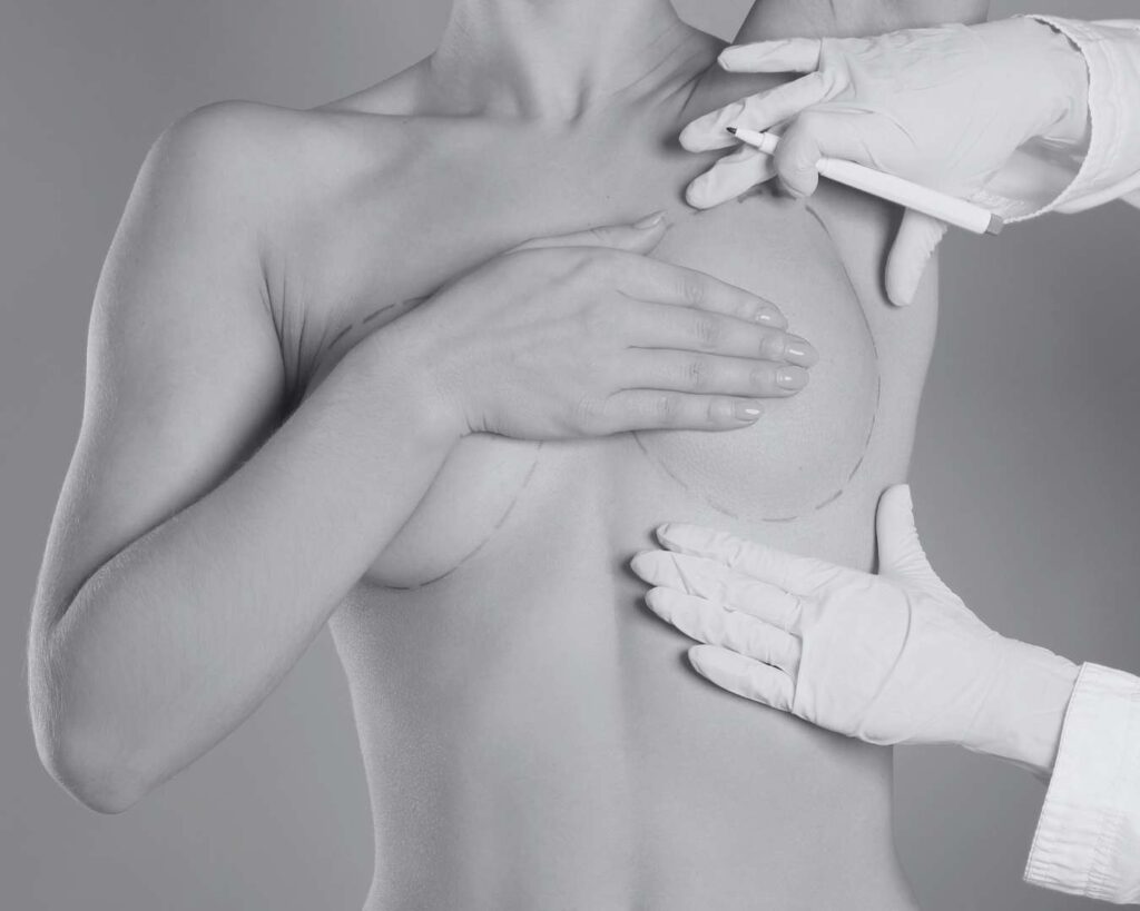 Prix chirurgie mammaire